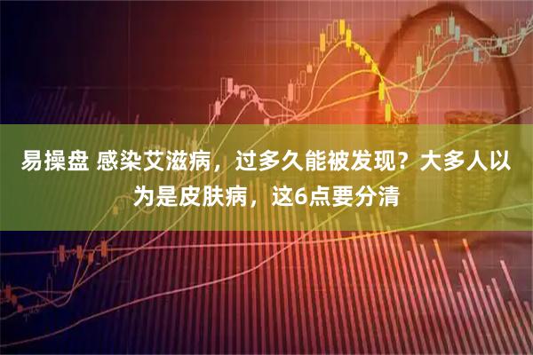 易操盘 感染艾滋病，过多久能被发现？大多人以为是皮肤病，这6点要分清